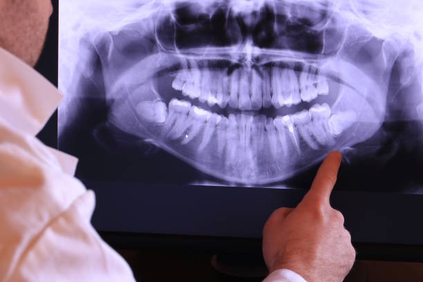 Best Emergency Dental Extractions in Richton, MS