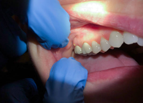 Best Mobile Emergency Dentist in Richton, MS